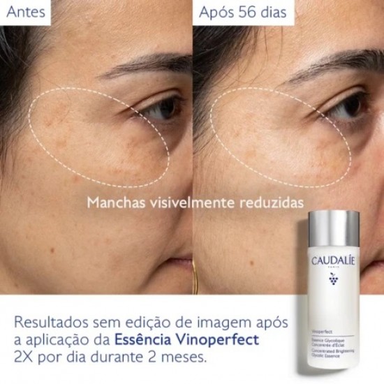 Caudalie Vinoperfect Concentrated Brightening Glycolic Essence Συμπύκνωμα Υγρής Μορφής Λάμψης Προσώπου Κατά των Ατελειών 100ml