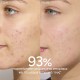 Caudalie Vinopure Moisturizing Mattifying Fluid Ενυδατική Κρέμα για Επιδερμίδες με Τάση Ακμής, 60ml